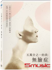 五萬分之一的我：無臉症